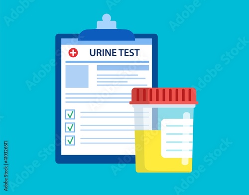 urine test Plastic jar and medical lab analysis form list with results data. Medical urine test records concept. Chemical laboratory analysis. Vector illustration in flat style © Rogatnev