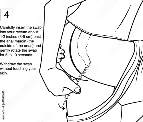 Carefully insert the swab into your rectum about 1-2 inches (3-5 cm) past the anal margin (the outside of the anus) and gently rotate the swab for 5 to 10 seconds.