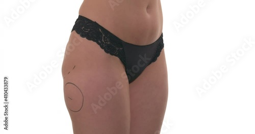 Marking problem parts of Caucasian woman buttocks. Preparation before buttock augmentation surgery. Slow motion. Beauty concept. Isolated on white background