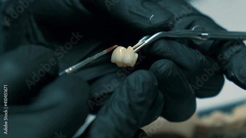 Dentist selects the color of the tooth, denture, artificial tooth, denture, hands working on the denture, artificial teeth. Slow motion, close-up.