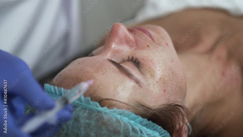 Woman on the procedure of mesotherapy injection with a syringe Woman on the procedure of mesotherapy injection with a syringe