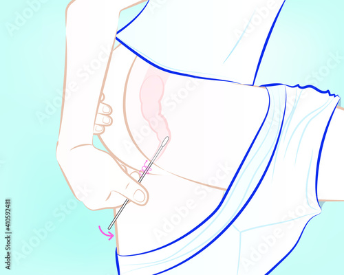 Carefully insert the swab into your rectum about 1-2 inches (3-5 cm) past the anal margin (the outside of the anus) and gently rotate the swab for 5 to 10 seconds