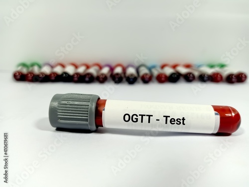 Blood sample for Oral Glucose Tolerance Test (OGTT). Three or Five Sample testing for the diagnosis of the tolerance of blood glucose in body. photo