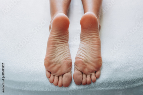 Closeup of woman feet with calluses and dry skin on towel in a procedure cabinet. Foot and toes care concept.