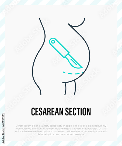 Cesarean section thin line icon. Scalpel near belly. Surgical operation for childbirth. Vector illustration.