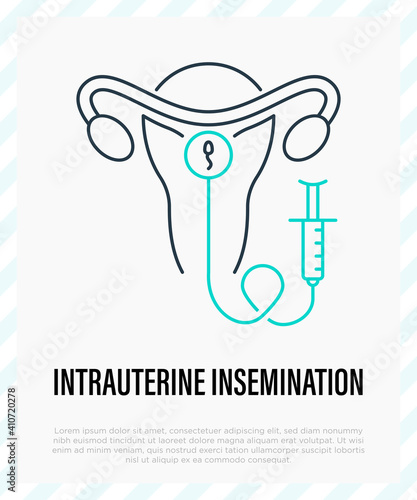 Intrauterine insemination thin line icon. Gynecology. EGG. Uterus and uterine device. Vector illustration.