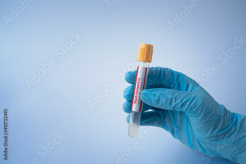 Nipah virus. Young woman wearing a medical face mask holding a glass test tube. Nipah Henipavirus is a newly emerging bat-borne virus. nipah virus infection. selective focus