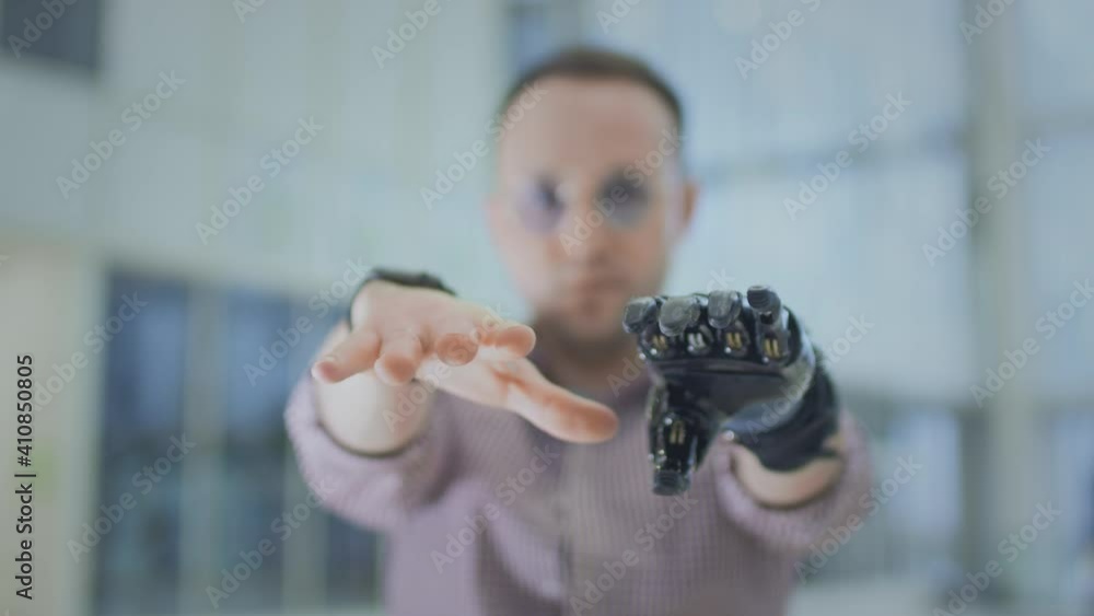 A man with a prosthetic arm. Artificial robotic arm, replaces hand and ...