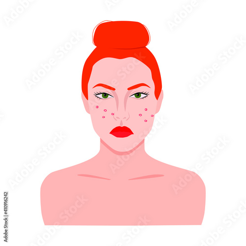 A woman with red hair is upset with acne on her face. Vector illustration of problems on the female skin of the face