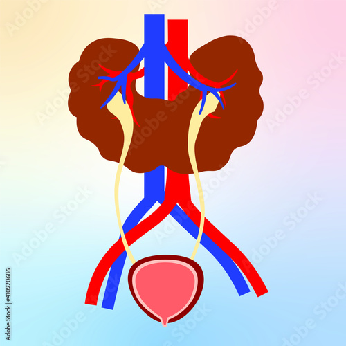Congenital disorder horseshoe kidney