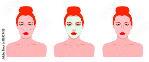 Vector set of facial skin care. Woman with red hair doing acne prevention