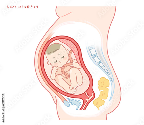 逆子の赤ちゃんのイラスト