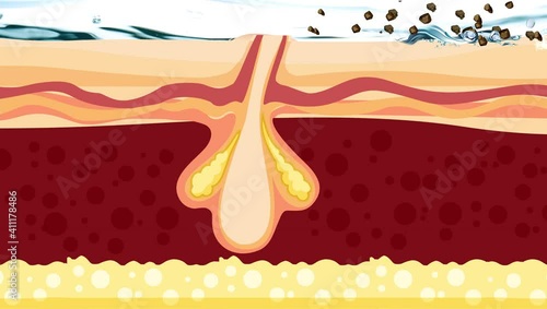 Skin rinsing process of dirty clog pores and cleaning pores and became clear skin