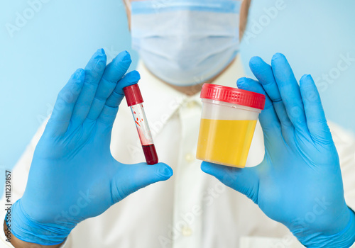 Doctor holding urine and blood samples for test close-up