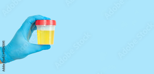 Hand holding urine sample container for medical urinalysis photo