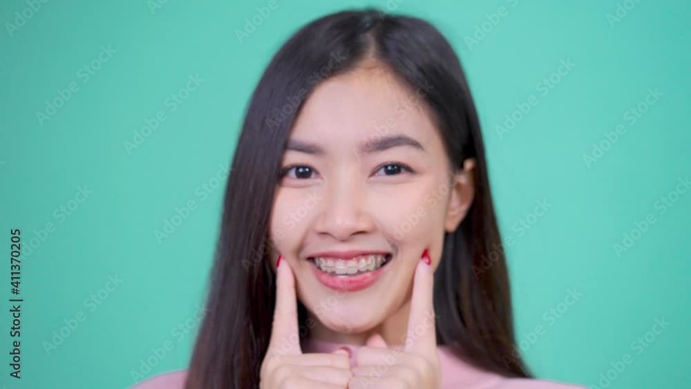 Beautiful smiling of young asian woman with retainer braces with white teeth increase confidence Beautiful smiling of young asian woman with retainer braces with white teeth increase confidence