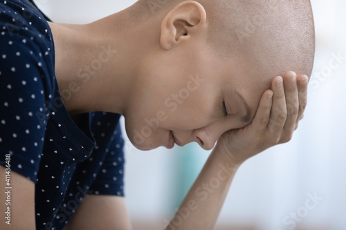 Close up of upset sad young Caucasian bald woman struggle with oncology feel depressed with bad analysis results. Unhappy millennial hairless cancer patient female distressed with illness symptoms.