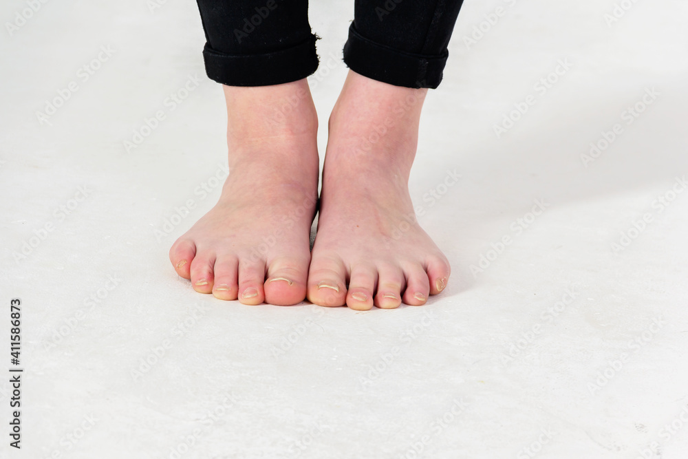 Female feet close up on a white background. Female feet close up on a white background.