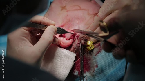 Plastic surgeon performs facelift surgery with a scalpel, tweezers and clamps, close up. High quality FullHD footage