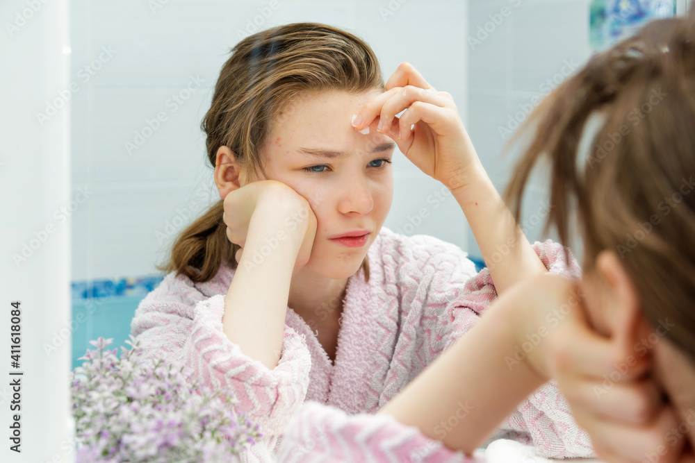sad girl removing pimples with a cotton swab sad girl removing pimples with a cotton swab