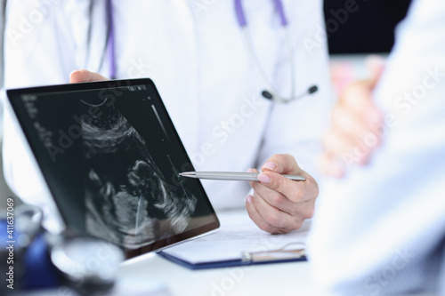 Tableau sur toile Doctor demonstrates fetal ultrasound on tablet screen