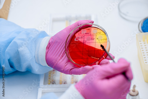 Close-up of bacterial inoculation culture in a petri dish. Laboratory bacterial analysis