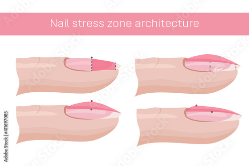 Nail care. The architecture of the nail stress zone, recovery. Illustration for a manual for manicure. Hand nail care .Vector illustration