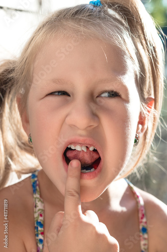 Little girl points the finger at a wobbly baby tooth