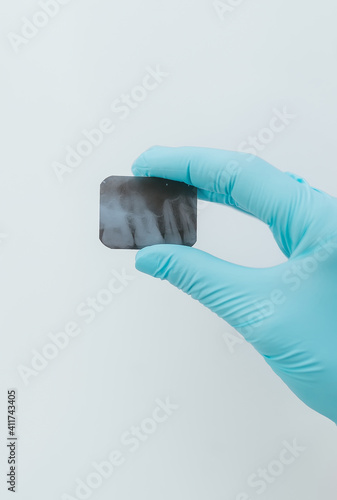 Hand in blue glove holding small dental x-ray. photo