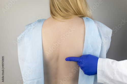 A woman at the doctor's appointment with back pain. Treatment of spinal deformity and stoop. Osteoporosis, kyphosis, lordosis, or scoliosis. photo