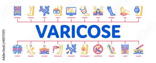 Varicose Veins Disease Minimal Infographic Web Banner Vector. Varicose Symptoms And Treatment, Legs Pain And Medicine Cream, Ultrasound And Surgery Color Illustration