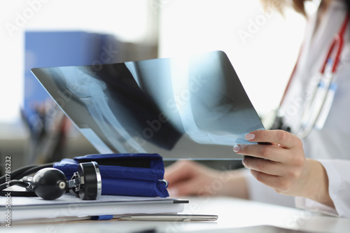 Doctors hands are holding x-ray in office closeup