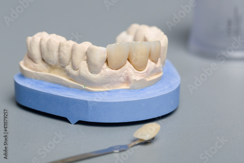 close up of checking veneer of tooth crown or implant with a shade guide in dental laboratory