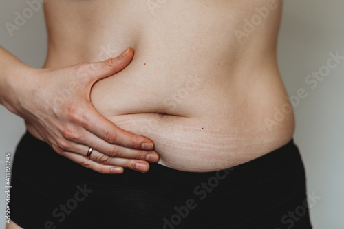 woman with hands on belly