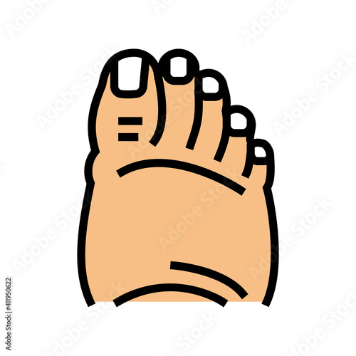 fatty foot edema color icon vector. fatty foot edema sign. isolated symbol illustration