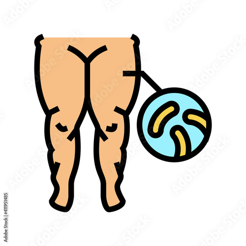 fatty edema color icon vector. fatty edema sign. isolated symbol illustration