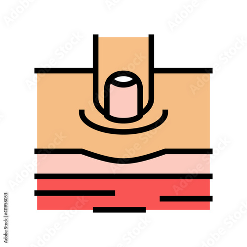 pitting edema on patient leg color icon vector. pitting edema on patient leg sign. isolated symbol illustration