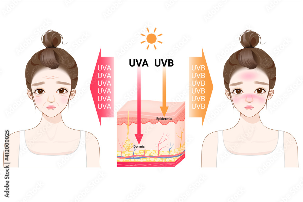 Uva uvb rays from sun penetrate into epidermis of skin cross-section of ...