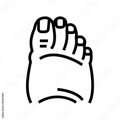 fatty foot edema line icon vector. fatty foot edema sign. isolated contour symbol black illustration