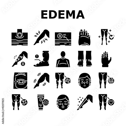 Edema Disease Symptom Collection Icons Set Vector. Venous And Fatty, Lymphatic And Hypoproteinemic, Allergic And Heart Edema Health Problem Glyph Pictograms Black Illustrations