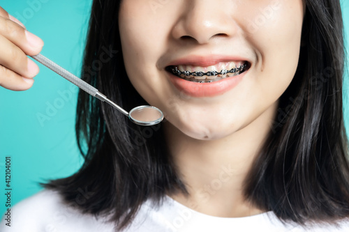 Asian woman wearing dental braces pointing to tooth sample and smiling with her healthy white teeth isolated shot on blue background