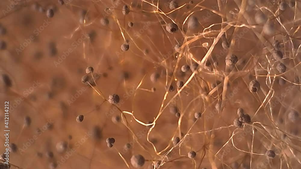 Microscope Mold Sporangium and Sporangiospore 600x Lighting Biology Fungi Microscope Mold Sporangium and Sporangiospore 600x Lighting Biology Fungi