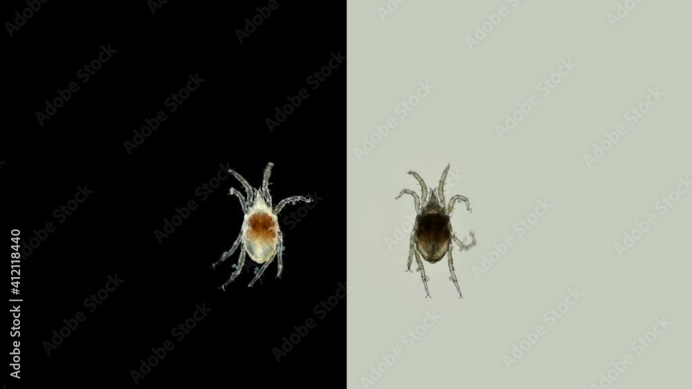Acari(mite) living in water under a microscope, the superfamily Halacaroidea, the order Trombidiformes. Sample found in the Volga River Acari(mite) living in water under a microscope, the superfamily Halacaroidea, the order Trombidiformes. Sample found in the Volga River