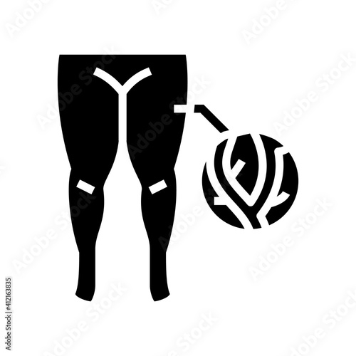 lymphatic edema glyph icon vector. lymphatic edema sign. isolated contour symbol black illustration