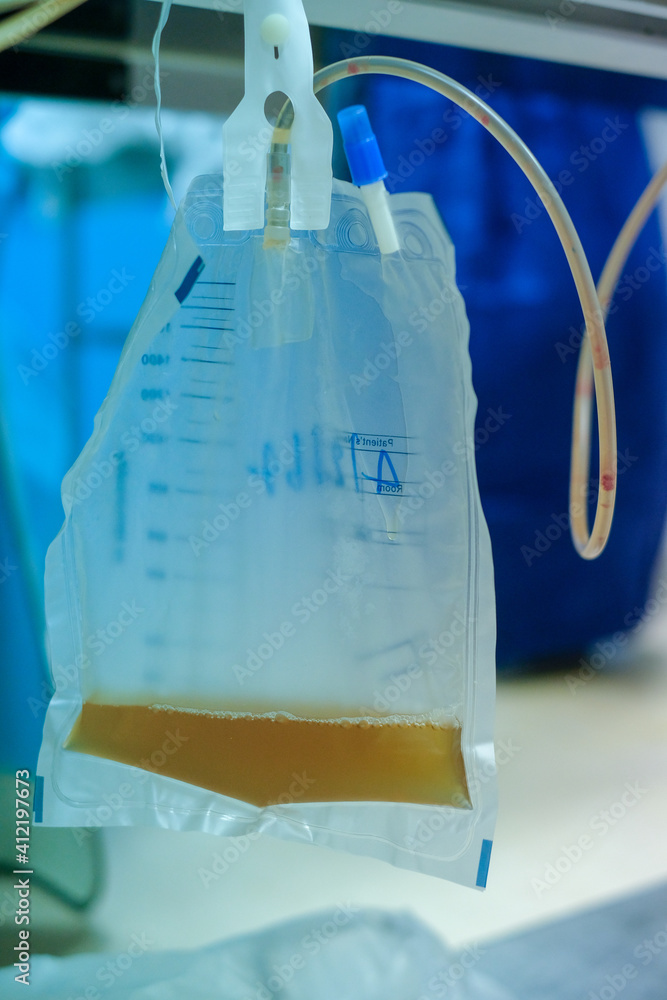 Urine bag medical treatment drainage bladder rubber flexible body