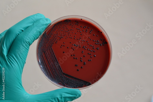 Canvas Print Corynebacterium, Corynebacterium colony morphology
Black colony on blood agar, C