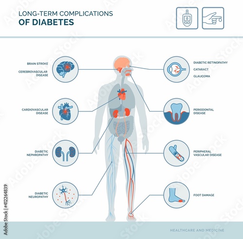 Long-term complications of diabetes