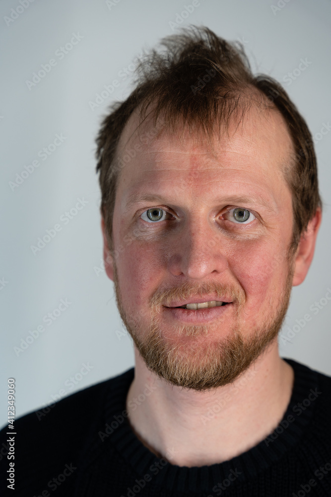 Portrait of a man where he looks straight and smiles with frizzy hair when he can see his teeth Portrait of a man where he looks straight and smiles with frizzy hair when he can see his teeth