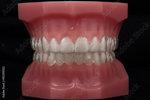 teeth