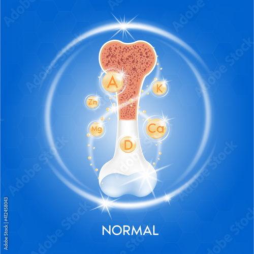 Calcium mineral gold. Glossy drop pill capsule Mineral and vitamin complex. Dietary supplement bone, Medical or healthcare concept.  Vector EPS10